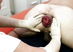 Marcus Pollack gets fisted and stretched with 2 hands