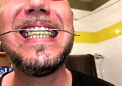 Horny Deepthroat Full Of Spit With Braces And Double Headgear