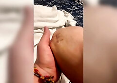 Undress tease and scars