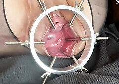 Phat Views Of My Wide Open Cunt And Cervix